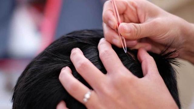 “뽑아야 하는 줄 알았는데”… 흰머리 뽑기 전에 알아야 할 놀라운 사실 5가지