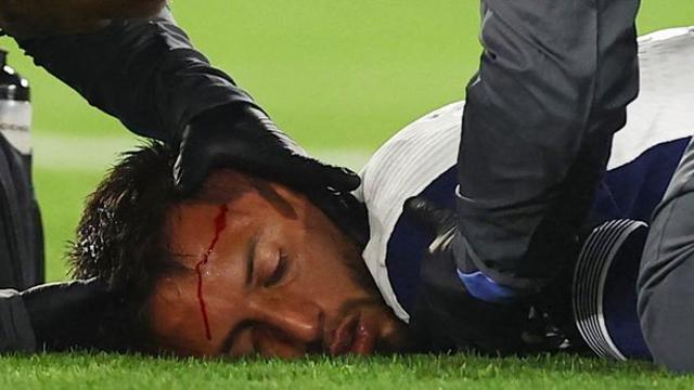 '피 철철+뇌진탕' 벤탄쿠르 