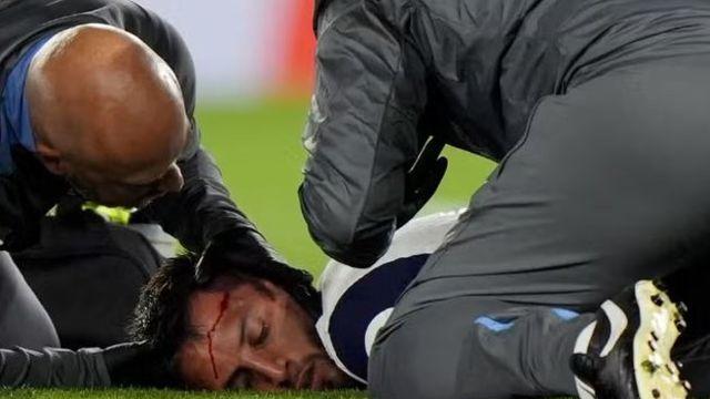 ‘충격 부상’ 벤탄쿠르, 머리 충돌→관자놀이에 큰 혹 2개...“예방 차원에서 MRI 검사 예정”