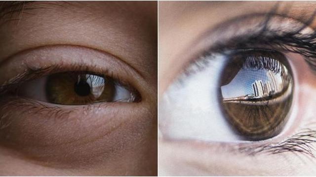 욕실 타일이 휘어 보인다면 얼른 병원에 가야... 자칫 시력 잃을 수도 있다