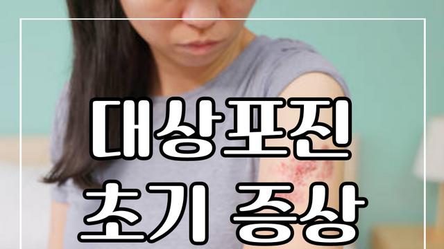 대상포진 초기 증상 10가지 빠른 대처법