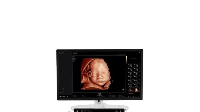 삼성메디슨, 프리미엄 초음파 진단기기 첫 공개