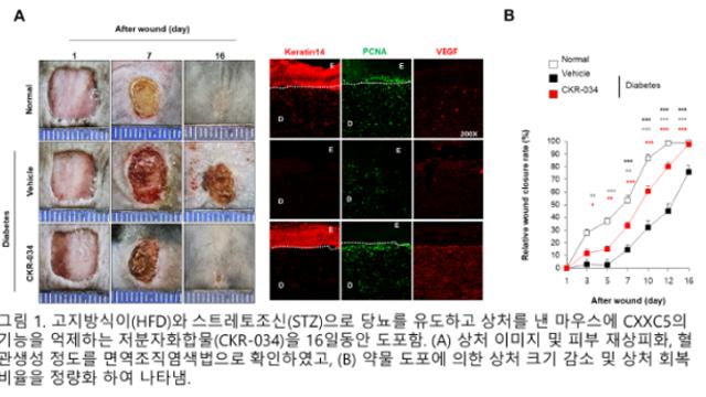 ㈜씨케이리제온, 당뇨병성 창상/족부괴양 치료용 미국 등 3개국 특허 등록 및 임상 1상 완료