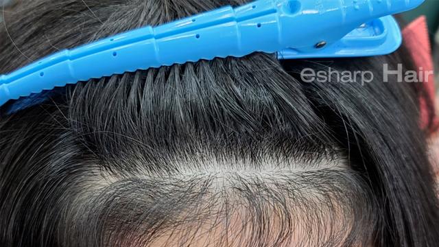 이런 곱슬 가진 사람 은근 있음…..