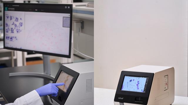 WHO 산하 UNITAID, 노을 AI 자궁경부암 진단 솔루션 사용 권고…로슈와 함께 선정됐다