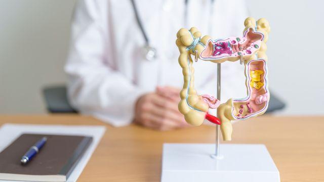 초기 증상 없는 ‘대장암’, 예방의 핵심은?