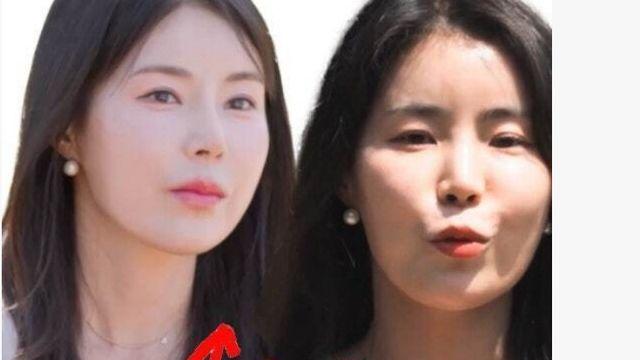 성형한 나는솔로 10기 영숙 근황