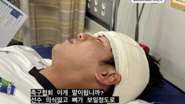 “뼈가 드러날 정도로 다쳤는데”…프로축구 선수, 구급차 못 탄 이유..