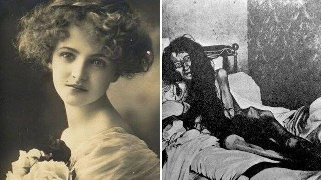 25년간 실종된 여성이 다락방에서 갇힌 채 발견되었던 사건.