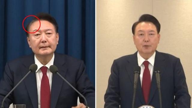 윤 대통령 달라진 모습 두고 '시끌'…누리꾼이 비교한 사진 보니
