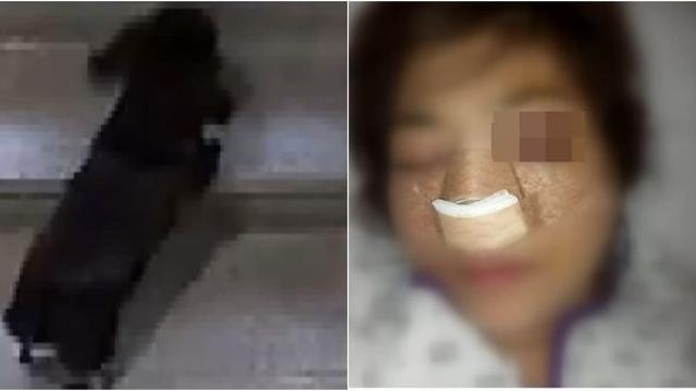 코뼈 골절...반려견 배변 치우라 했다가 이웃집 모자에게 폭언·폭행당한 여성