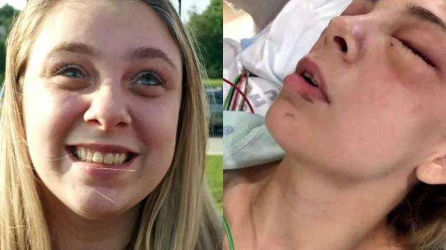 스스로 자신의 양 눈을 뽑아버린 20대 女.JPG