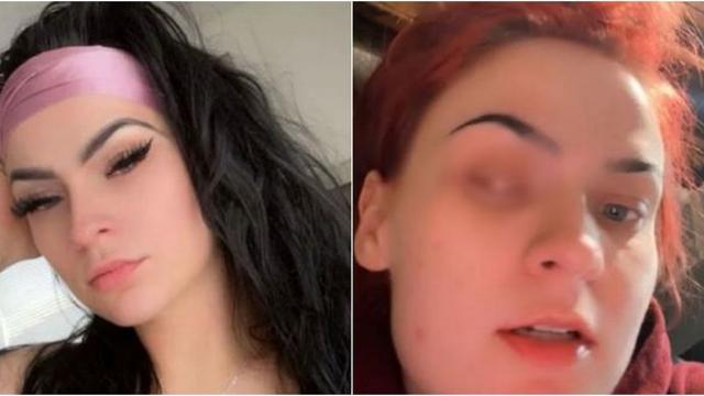 속눈썹 붙이려다가 안구 적출하게 된 여성…대체 무슨 일이?