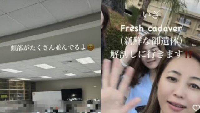 “신선한 시신 해부!” SNS에 시신 올린 日 의사 ‘발칵’