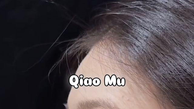 요즘 유행 한다는 억매부리코 성형