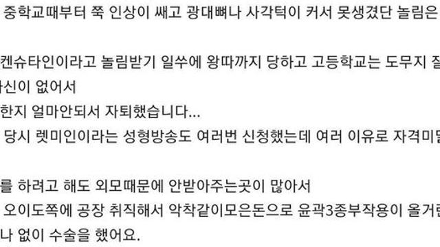 얼굴형 자체가 못생긴 20대 일반인 한국여자의 인생 