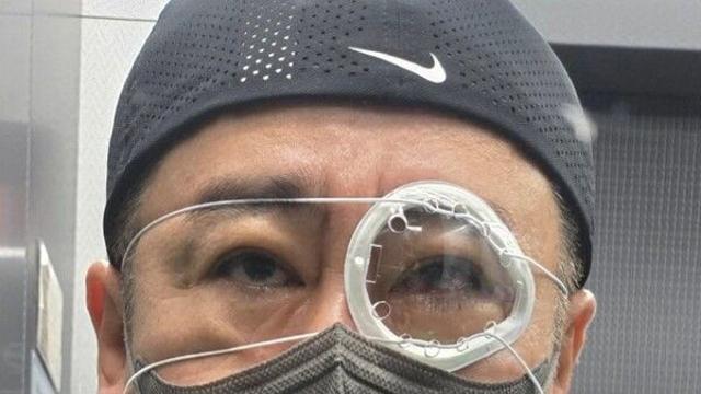 [스타&헬스] 이광기, 망막박리 수술로 활동 중단... 