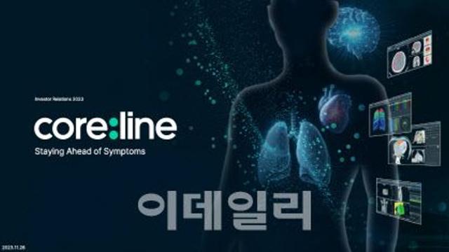 코어라인소프트 AI 폐암 검진 솔루션, 1차 판독 도구 사용 가능성 입증