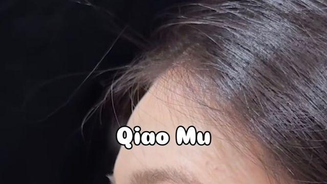 최근 유행 한다는 억매부리코 성형