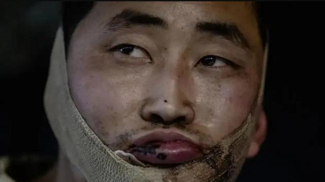 우크라에 생포된 북한군 포로, 한국 귀순 가능할까