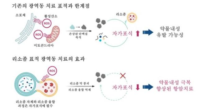 항암제 안 듣는 췌장암, 빛으로 죽인다