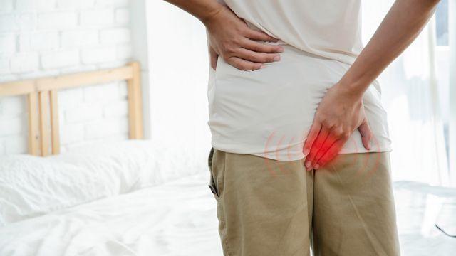 [헬스S] 50대 절반이 앓는다는 '치핵'… 시술·수술, 무엇이 나을까