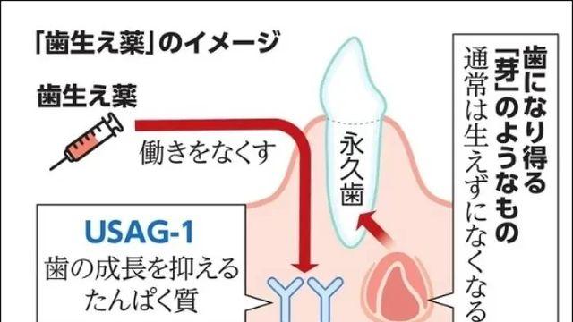 일본 치아 재생 기술