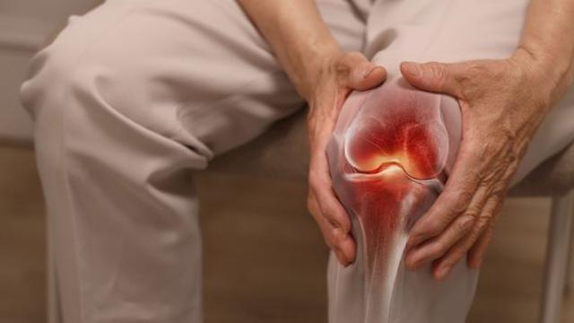 나이에 상관 없이 찾아오는 '이 질환'…당신의 관절을 위협한다