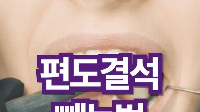 편도결석 원인과 빼는법 쉽고 빠르게!