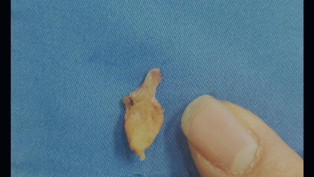 수 많은 의사들이 포기한 불치병 치료 한 썰. JPG