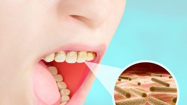 [건강물음표] 겨울철 심해지는 '구강건조증', 방치하면 전신 건강 해친다?
