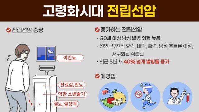 증가하는 전립선암, 50대 이상 남성 정기검진 필수