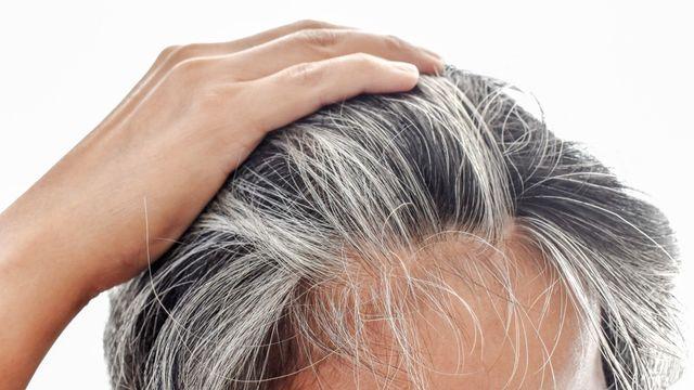 나이 먹을수록 하얗게 세어가는 머리…'이것' 먹고 예방할 수 있다고?