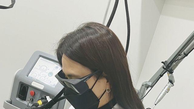 기미·잡티 색소질환 치료하는 레이저 토닝… 확인사항은?