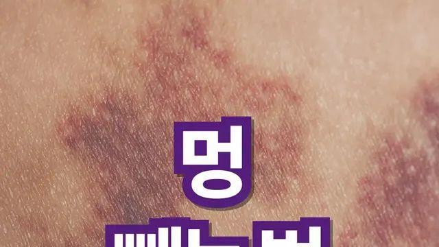 멍 빨리 빼는 법: 확실하게 알려드립니다.