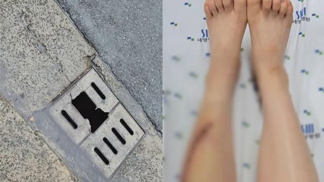 아기 안은 채 '철퍼덕'… 깨진 하수구 밟은 여성 