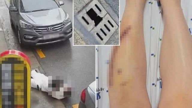 아기 안은 채 부서진 '하수구 덮개' 밟고 넘어진 여성... 
