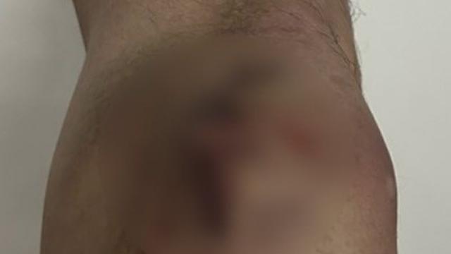 지하철 타러 가다 각목 '날벼락'…송도서 묻지마 폭행 발생