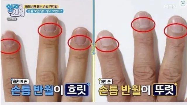 한의사 피셜 당뇨 진단법