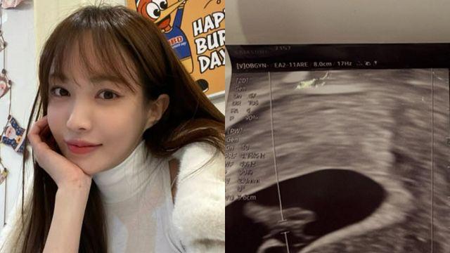 임신 사실 알린 서은우 