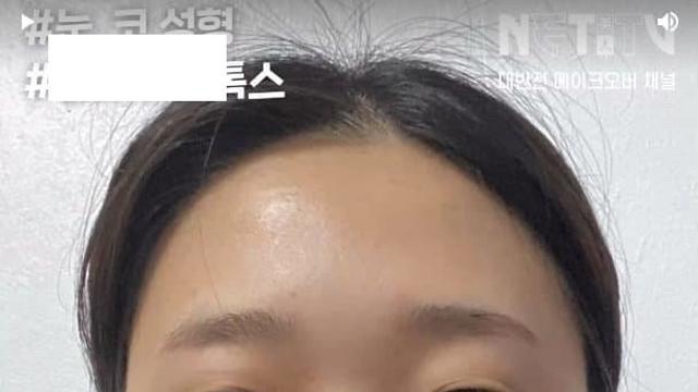 성형수술의 순기능