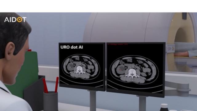 아이도트, AI 요로결석 진단 소프트웨어 '유로닷에이아이' 복지부 신의료기술 고시 완료