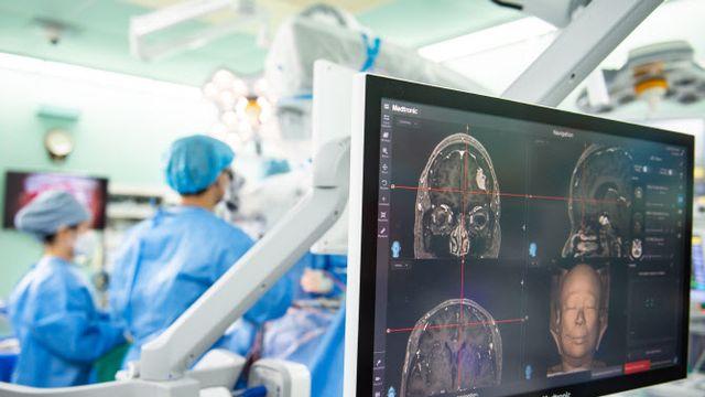 고대안산병원, 뇌종양 수술 1,200례 달성