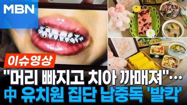 中, 유치원 집단 납중독 발칵... 머리 빠지고 치아 까매져