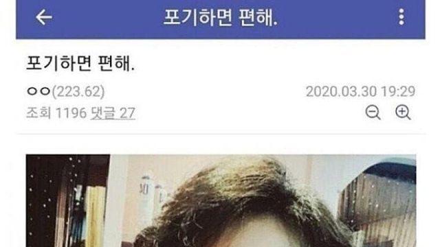 탈모 전후사진 레전드.jpg