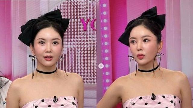 장영란, 4번째 눈성형 후 물오른 미모