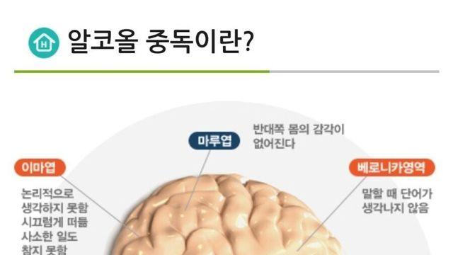 알콜이 뇌에게 미치는 영향