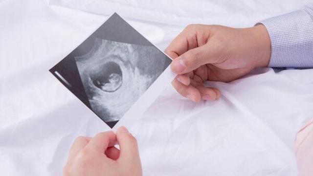 해외 출장 다녀 왔더니…호적에 모르는 '아이' 등재 무슨 일?