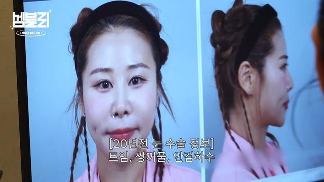 ‘서준맘’ 박세미, 또 눈+코 수술 고백…”이미 1000만 원 쓴 얼굴” [RE:뷰]