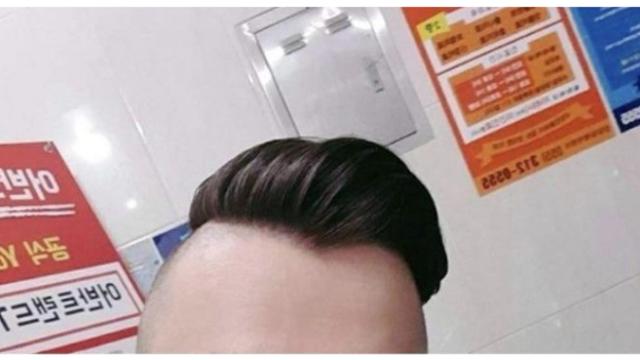망한 남자 머리.